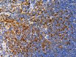 Phospho-AS160 (Ser588) Antibody in Immunohistochemistry (Paraffin) (IHC (P))