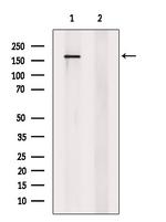 Phospho-AS160 (Ser588) Antibody in Western Blot (WB)