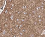 Phospho-c-Abl (Tyr226) Antibody in Immunohistochemistry (Paraffin) (IHC (P))