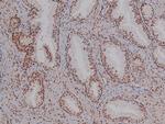 Phospho-CDK4 (Thr172) Antibody in Immunohistochemistry (Paraffin) (IHC (P))