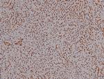 Phospho-CDK4 (Thr172) Antibody in Immunohistochemistry (Paraffin) (IHC (P))