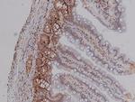 Phospho-CDK4 (Thr172) Antibody in Immunohistochemistry (Paraffin) (IHC (P))