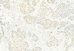 Phospho-CDK4 (Thr172) Antibody in Immunohistochemistry (Paraffin) (IHC (P))