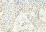 Phospho-CDK4 (Thr172) Antibody in Immunohistochemistry (Paraffin) (IHC (P))