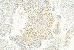 Phospho-CDK4 (Thr172) Antibody in Immunohistochemistry (Paraffin) (IHC (P))