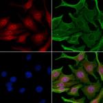 Phospho-Chk2 (Ser33, Ser35) Antibody in Immunocytochemistry (ICC/IF)