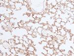 Phospho-Chk2 (Ser33, Ser35) Antibody in Immunohistochemistry (Paraffin) (IHC (P))