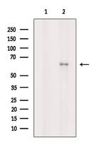 Phospho-Chk2 (Ser33, Ser35) Antibody in Western Blot (WB)