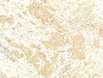 Phospho-C-Jun (Ser73) Antibody in Immunohistochemistry (Paraffin) (IHC (P))