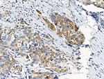 Phospho-Cytokeratin 18 (Ser51) Antibody in Immunohistochemistry (Paraffin) (IHC (P))