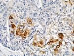 Phospho-Cytokeratin 18 (Ser51) Antibody in Immunohistochemistry (Paraffin) (IHC (P))