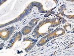 Phospho-Cytokeratin 18 (Ser51) Antibody in Immunohistochemistry (Paraffin) (IHC (P))