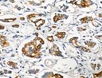 Phospho-Cytokeratin 18 (Ser51) Antibody in Immunohistochemistry (Paraffin) (IHC (P))