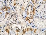 Phospho-Cytokeratin 18 (Ser51) Antibody in Immunohistochemistry (Paraffin) (IHC (P))