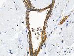 Phospho-Cytokeratin 18 (Ser51) Antibody in Immunohistochemistry (Paraffin) (IHC (P))