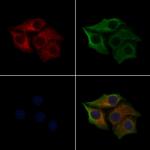 Phospho-Cytokeratin 8 (Ser432) Antibody in Immunocytochemistry (ICC/IF)