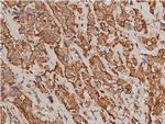 Phospho-Cytokeratin 8 (Ser432) Antibody in Immunohistochemistry (Paraffin) (IHC (P))