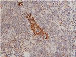 Phospho-Cytokeratin 8 (Ser432) Antibody in Immunohistochemistry (Paraffin) (IHC (P))