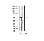 Phospho-Cytokeratin 8 (Ser432) Antibody in Western Blot (WB)