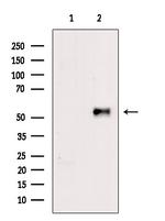 Phospho-Cytokeratin 8 (Ser432) Antibody in Western Blot (WB)