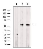 Phospho-Cytokeratin 8 (Ser432) Antibody in Western Blot (WB)