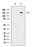 Phospho-DNMT1 (Tyr399) Antibody in Western Blot (WB)