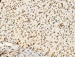 Phospho-GSK3B (Thr390) Antibody in Immunohistochemistry (Paraffin) (IHC (P))