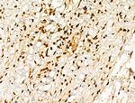 Phospho-GSK3B (Thr390) Antibody in Immunohistochemistry (Paraffin) (IHC (P))