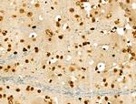 Phospho-GSK3B (Thr390) Antibody in Immunohistochemistry (Paraffin) (IHC (P))