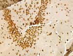 Phospho-GSK3B (Thr390) Antibody in Immunohistochemistry (Paraffin) (IHC (P))