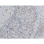 Phospho-Histone H2A.X (Ser140) Antibody in Immunohistochemistry (Paraffin) (IHC (P))