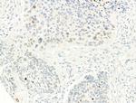 Phospho-Histone H2A.X (Ser140) Antibody in Immunohistochemistry (Paraffin) (IHC (P))