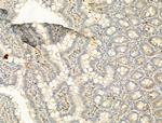 Phospho-Histone H2A.X (Ser140) Antibody in Immunohistochemistry (Paraffin) (IHC (P))