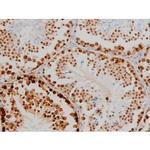 Phospho-Histone H2A.X (Ser140) Antibody in Immunohistochemistry (Paraffin) (IHC (P))