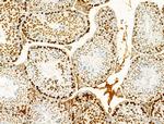 Phospho-Histone H2A.X (Ser140) Antibody in Immunohistochemistry (Paraffin) (IHC (P))