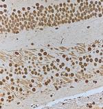 Phospho-HSF1 (Ser303) Antibody in Immunohistochemistry (Paraffin) (IHC (P))