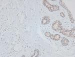 Phospho-Huntingtin (Ser419) Antibody in Immunohistochemistry (Paraffin) (IHC (P))