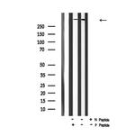 Phospho-Huntingtin (Ser419) Antibody in Western Blot (WB)