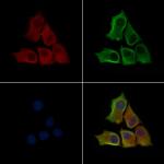 Phospho-ILK (Thr173) Antibody in Immunocytochemistry (ICC/IF)