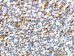 Phospho-ILK (Thr173) Antibody in Immunohistochemistry (Paraffin) (IHC (P))