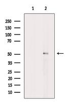 Phospho-ILK (Thr173) Antibody in Western Blot (WB)