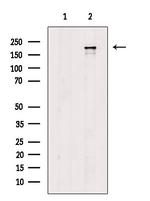 Phospho-CD104 (Thr1530) Antibody in Western Blot (WB)