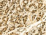 Phospho-JAK2 (Tyr1008) Antibody in Immunohistochemistry (Paraffin) (IHC (P))