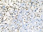 Phospho-JAK2 (Tyr1008) Antibody in Immunohistochemistry (Paraffin) (IHC (P))