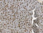 Phospho-JAK2 (Tyr1008) Antibody in Immunohistochemistry (Paraffin) (IHC (P))