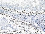 Phospho-JIP1 (Thr205) Antibody in Immunohistochemistry (Paraffin) (IHC (P))