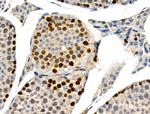 Phospho-MCM2 (Ser41) Antibody in Immunohistochemistry (Paraffin) (IHC (P))