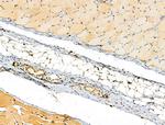 Phospho-MYPT1 (Ser473) Antibody in Immunohistochemistry (Paraffin) (IHC (P))