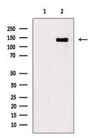 Phospho-Nephrin (Tyr1217) Antibody in Western Blot (WB)