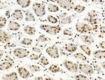 Phospho-NPM1 (Ser125) Antibody in Immunohistochemistry (Paraffin) (IHC (P))